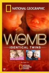 国家地理-子宫日记:同卵双胞胎 In the Womb: Identical Twins