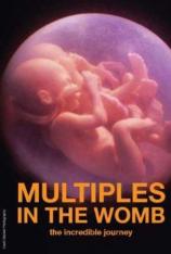 国家地理-子宫日记:多胞胎 In the Womb: Multiples